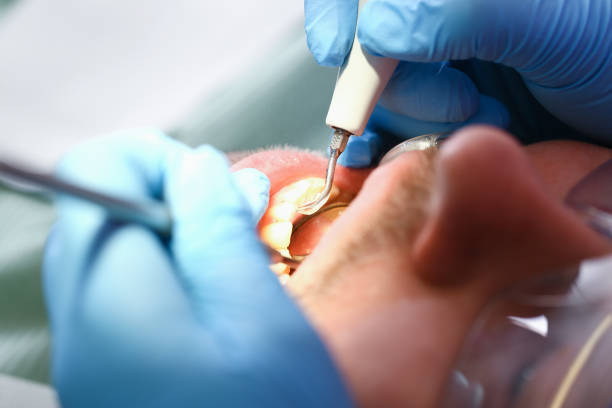 Best Urgent Tooth Repair  in Berlin, NJ