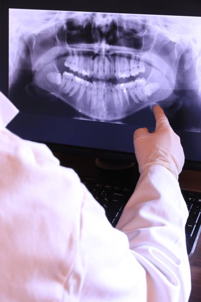 Best Chipped Tooth Repair Near Me  in Berlin, NJ