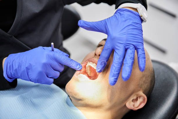 Best Knocked-Out Tooth Emergency  in Berlin, NJ